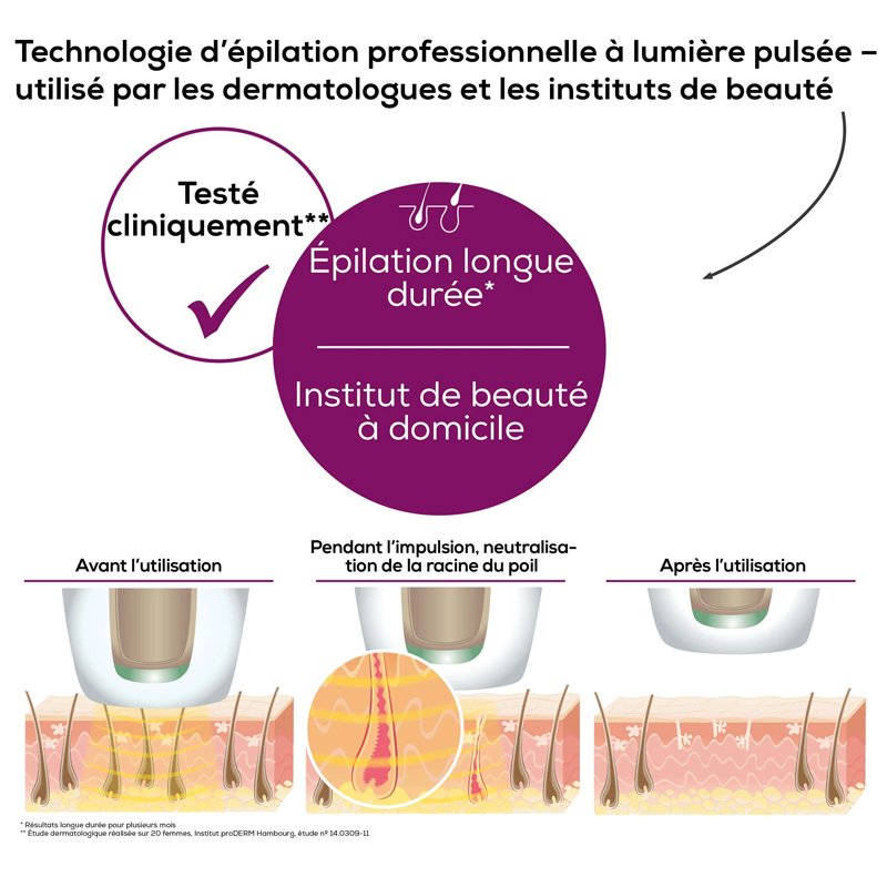 Épilateur BEURER à Lumière Pulsée - Noir (IPL5800) 4 epilateur beurer a lumiere pulsee noir ipl