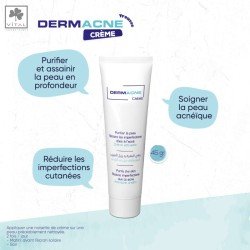 VITAL DERMACNE CREME 45GR 2 vital dermacne creme gr